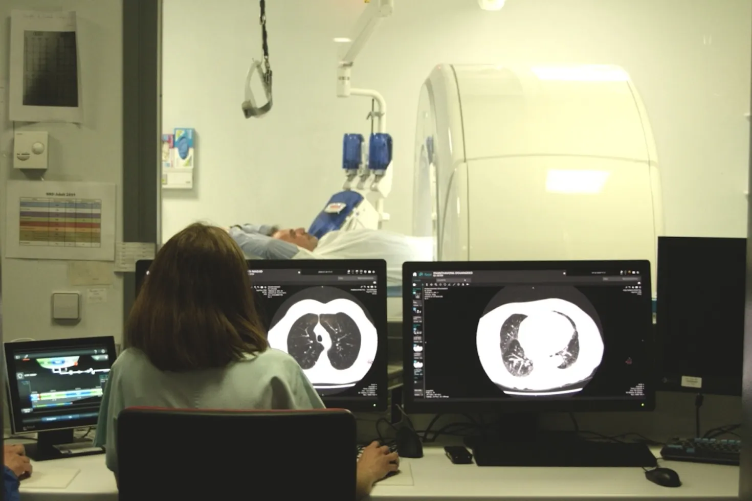 Lung cancer patient getting an MRI while a health worker looks at the scans on two computer screens